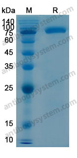 Recombinant Human CD106/VCAM1 Protein, N-His