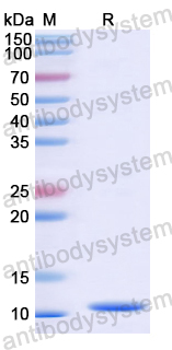 Recombinant Human NCL Protein, N-His