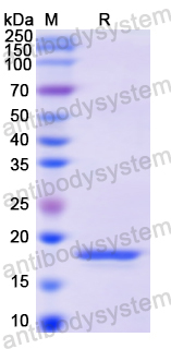 Recombinant Human HK1 Protein, N-His