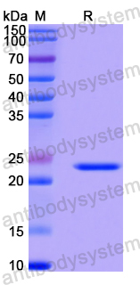 Recombinant Human ELK1 Protein, N-His-SUMO
