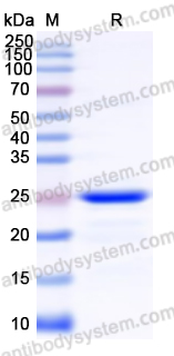 Recombinant Human TNNI3 Protein, N-His