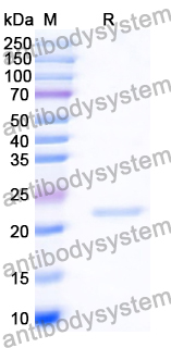 Recombinant Human CD120a/TNFRSF1A/TNFR1 Protein, N-His-SUMO