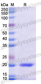 Recombinant Human CD224/GGT1 Protein, N-His