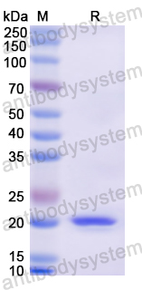 Recombinant Human ERCC3 Protein, N-His