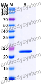Recombinant Human TRIM21/RO52 Protein, N-His