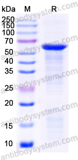 Recombinant Human TFEB Protein, N-His