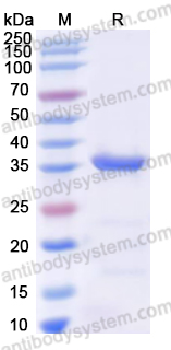 Recombinant Human EIF2AK2 Protein, N-His