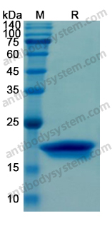 Recombinant Human ORM2 Protein, N-His