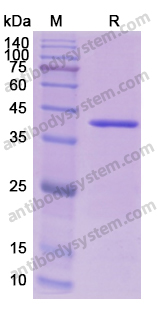 Recombinant Human AOC1/DAO Protein, N-His