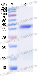 Recombinant Human ITIH2 Protein, N-His