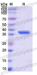 Recombinant Human ITIH1 Protein, N-His