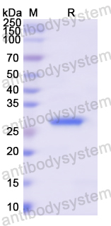 Recombinant Human CEL Protein, N-His