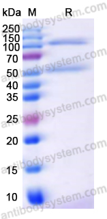 Recombinant Human NFKB1 Protein, N-His