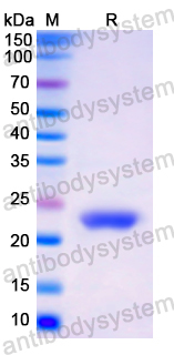 Recombinant Human NCF2 Protein, N-His