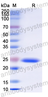 Recombinant Human TYMP/PD-ECGF Protein, N-His