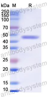 Recombinant Human TCN1 Protein, N-His