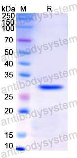 Recombinant Human KLK2 Protein, N-His