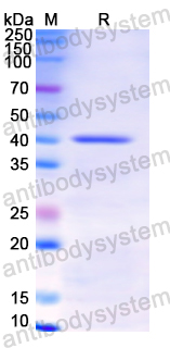 Recombinant Human TBP Protein, N-His