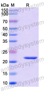 Recombinant Human POU3F3 Protein, N-His-SUMO
