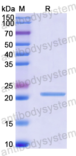 Recombinant Human POU3F2 Protein, N-His-SUMO