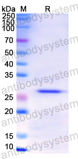 Recombinant Human CD120b/TNFRSF1B/TNFR2 Protein, N-His