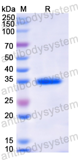 Recombinant Human MX1 Protein, N-His