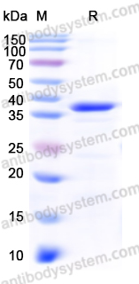 Recombinant Human MX2 Protein, N-His