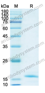 Recombinant Human LMNB1 Protein, N-His