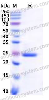 Recombinant Human DDC Protein, N-His