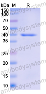 Recombinant Human PZP Protein, N-His