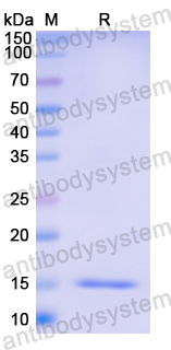 Recombinant Human OGN Protein, N-His