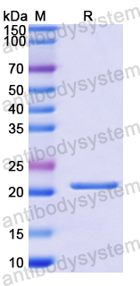 Recombinant Human IL11 Protein, N-His