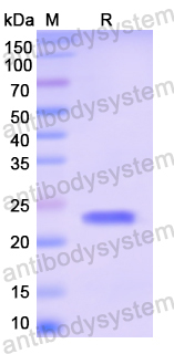 Recombinant Human CAST Protein, N-His