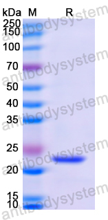 Recombinant Human SERPINA2 Protein, N-His