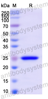 Recombinant Human AGA Protein, N-His