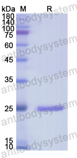 Recombinant Human RASA1 Protein, N-His