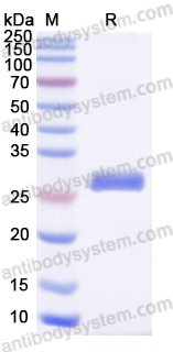 Recombinant Human GSTM3 Protein, N-His