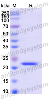 Recombinant Human CSRP1 Protein, N-His