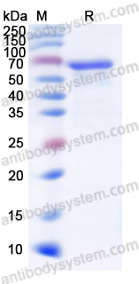 Recombinant Human MAOA Protein, N-His