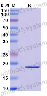 Recombinant Human TACR2 Protein, N-His-SUMO