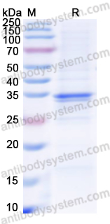 Recombinant Human FPR1 Protein, N-GST