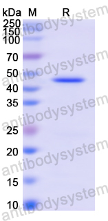 Recombinant Human AGXT Protein, N-His