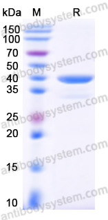 Recombinant Human CNR1/CB1 Protein, N-GST & C-His