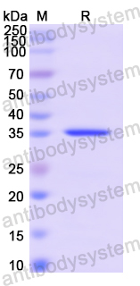 Recombinant Human SYT1 Protein, N-His