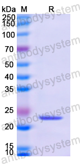 Recombinant Human SAT1 Protein, N-His