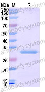 Recombinant Human EPHA1 Protein, N-His