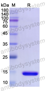 Recombinant Human DRD1 Protein, N-His