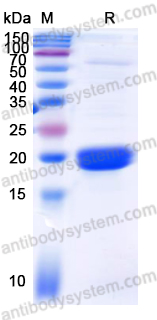 Recombinant Human CD88/C5AR1 Protein, N-His-SUMO