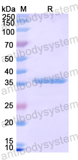 Recombinant Human TBXA2R Protein, N-His