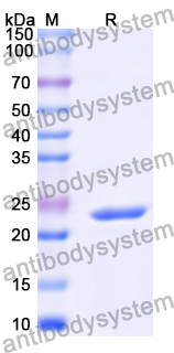 Recombinant Human ZP3 Protein, N-His